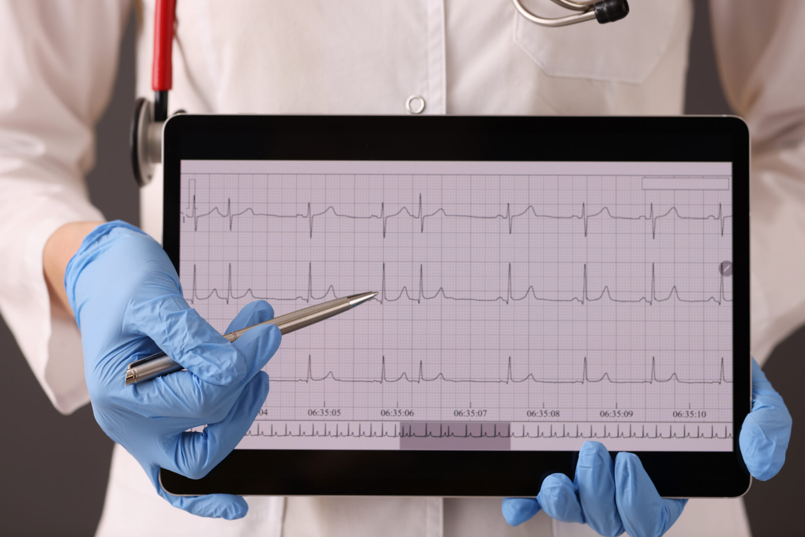 Doctor in rubber gloves holding digital tablet with cardiogram closeup